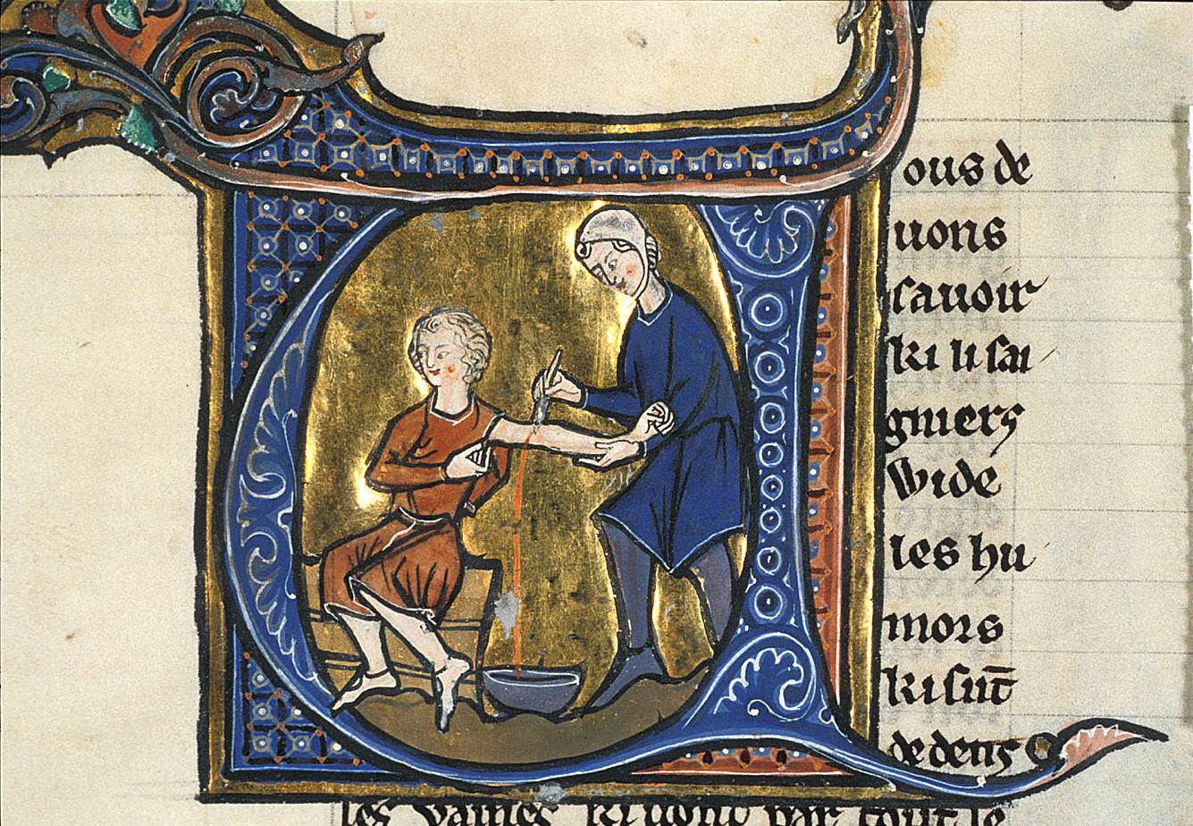 Bloodletting, 1285, France, Siena: "Le regime du corps", folio 11v