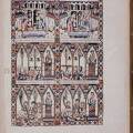 Cantigas de Santa Maria 134. Chirurg provádí amputaci pravé nohy pod kolenem.